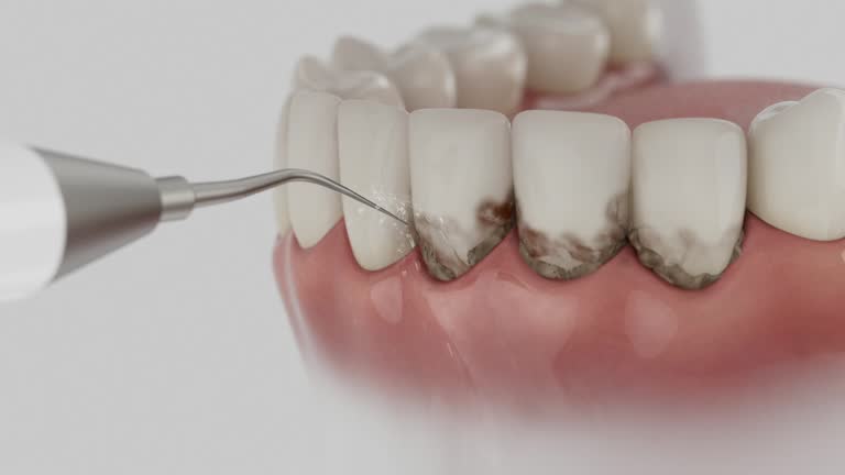 Trusted Tooth Extraction service in Eagle, CO - Dentist Open Now